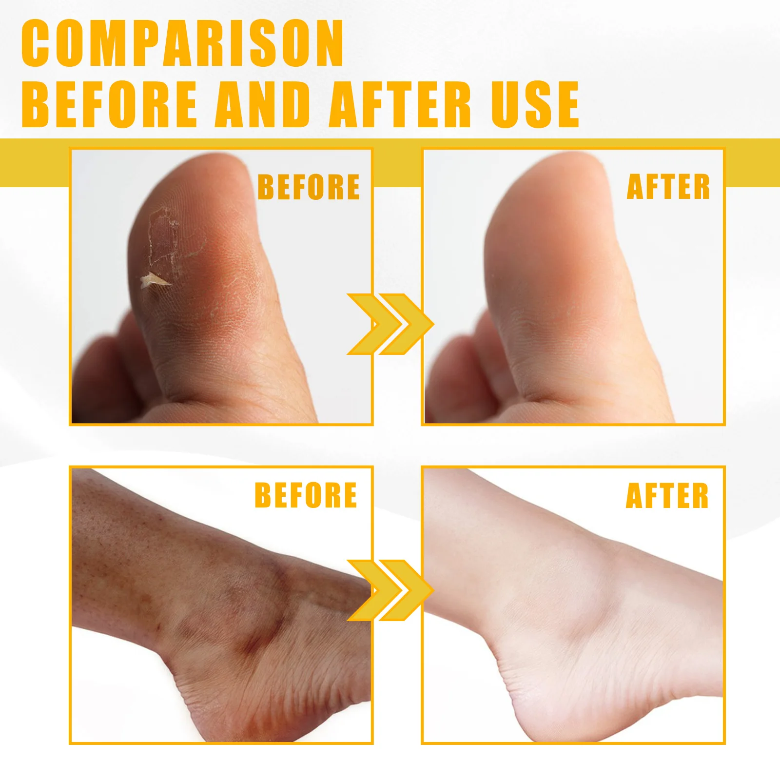 Natural Yellow Peeling Oil Extra Strong Whitening Exfoliating Bleaching Dark Skin Hands Feet Body Care Solution for All Skin