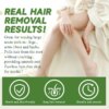 Aloe Wax Beads For Hair Removal Removing Hair From Armpits Leg And Hand Gentle Non Irritating Beautifying Skin Body Care Product - Image 5