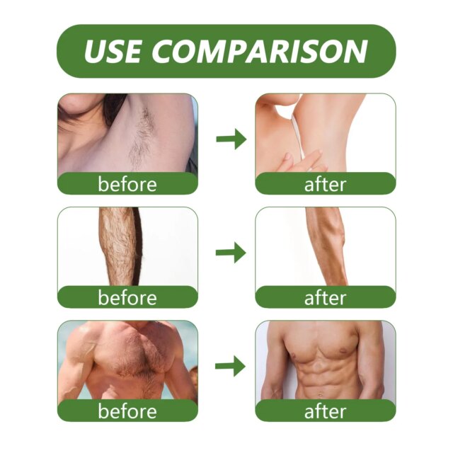 Aloe Wax Beads For Hair Removal Removing Hair From Armpits Leg And Hand Gentle Non Irritating Beautifying Skin Body Care Product - Image 2