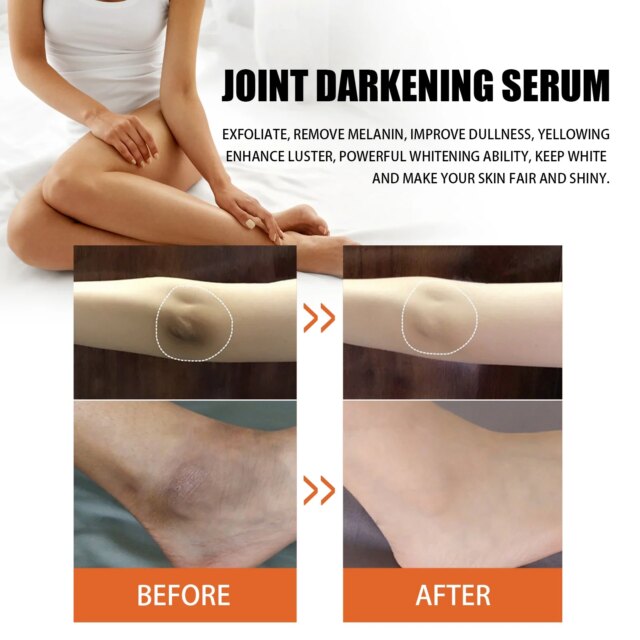 10Pcs Papaya Seed Beauty Oil Diminish Dark Spots Improve Joint And Elbow Melanin Moisturizing Brighten Skin Body Care Products - Image 4