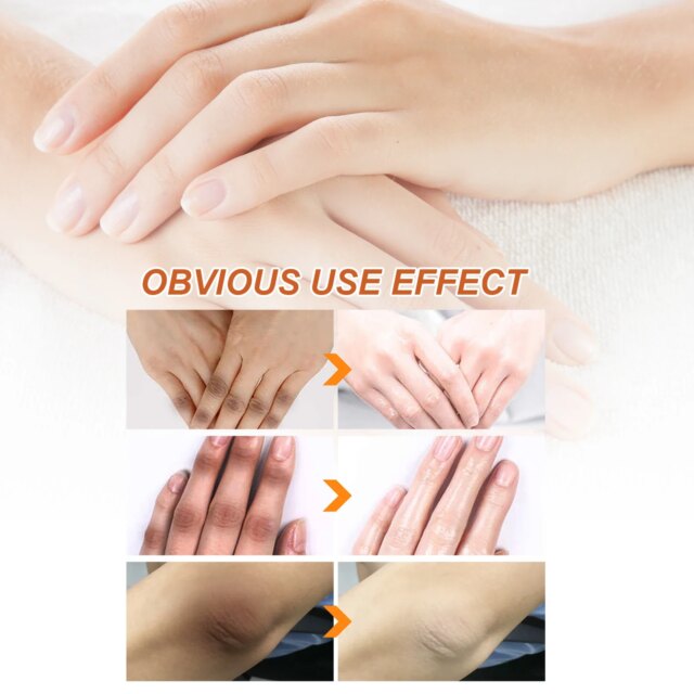 10Pcs Papaya Seed Beauty Oil Diminish Dark Spots Improve Joint And Elbow Melanin Moisturizing Brighten Skin Body Care Products - Image 3