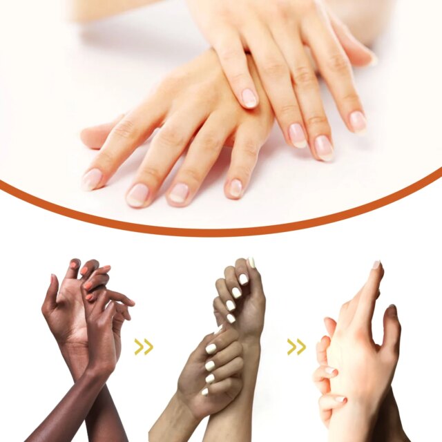 10Pcs Papaya Seed Beauty Oil Diminish Dark Spots Improve Joint And Elbow Melanin Moisturizing Brighten Skin Body Care Products - Image 5