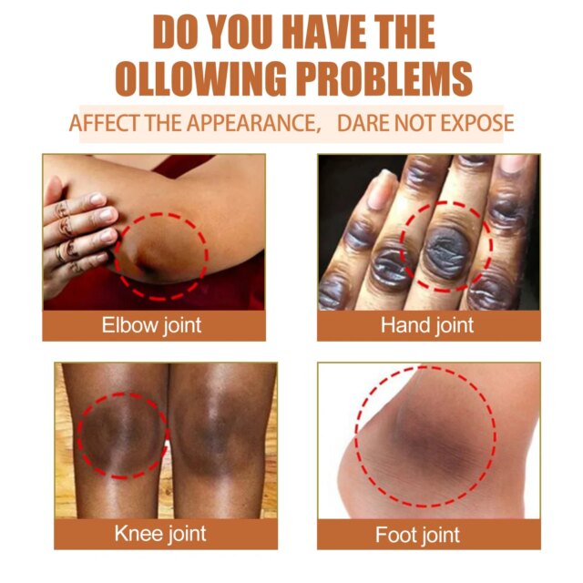 10Pcs Papaya Seed Beauty Oil Diminish Dark Spots Improve Joint And Elbow Melanin Moisturizing Brighten Skin Body Care Products - Image 2