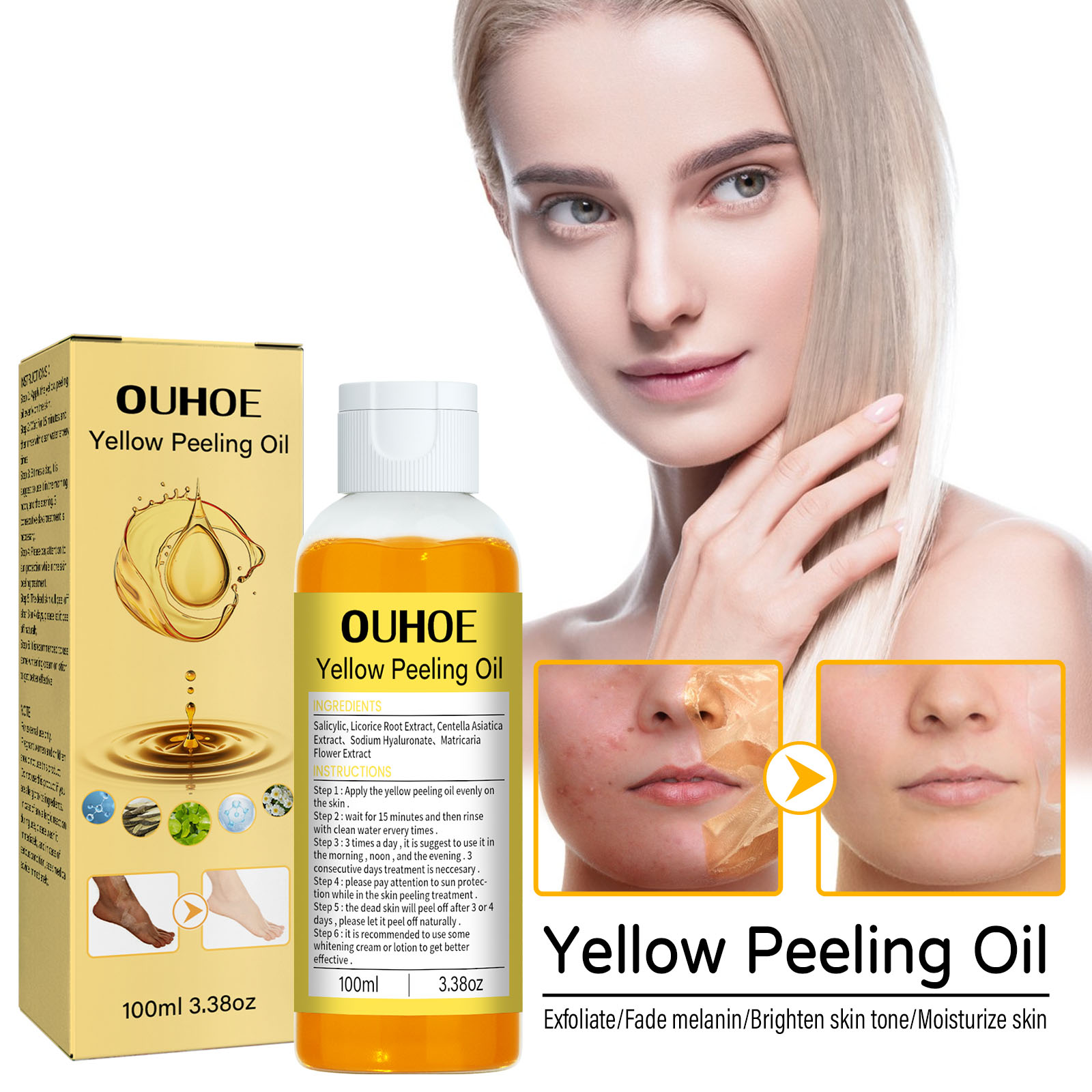 2Pcs Yellow Peeling Oil Skin Repair Essence Set Whitening Skin Repairing & Nourishing All Skin Type Strong Peeling Oi Body Care