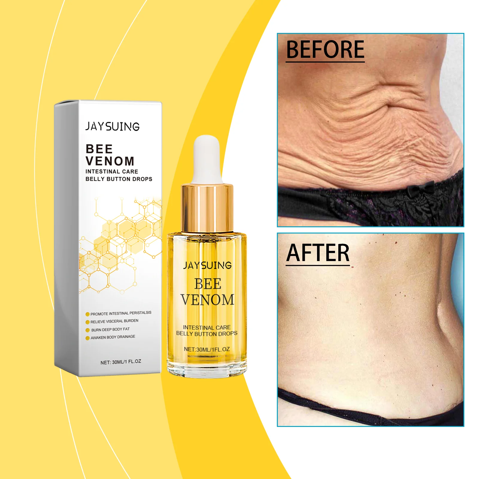 30ml Bee venom body essence Improve skin texture, nourish and tighten skin, moisturize body care, massage essence oil