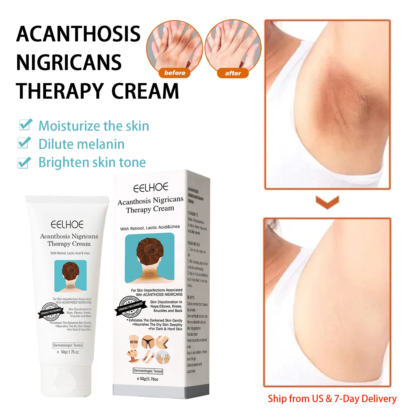 Black Acanthoderma Moisturizing Repair Cream Brightening Armpits Arms Knees Lightening Emulsion Brighten Skin Body Care Cream