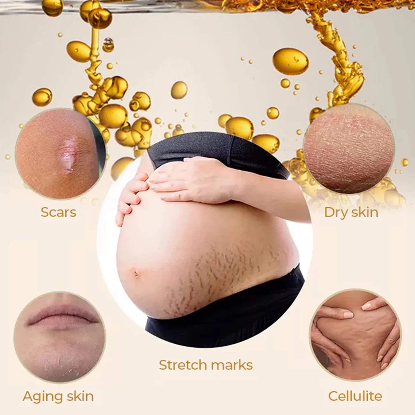 Olive Smoothing Oil Stretch Mark Pregnancy Removal Massage Anti-Wrinkle Lifting Firming Fade Scar Repair Skin Care Essential Oil