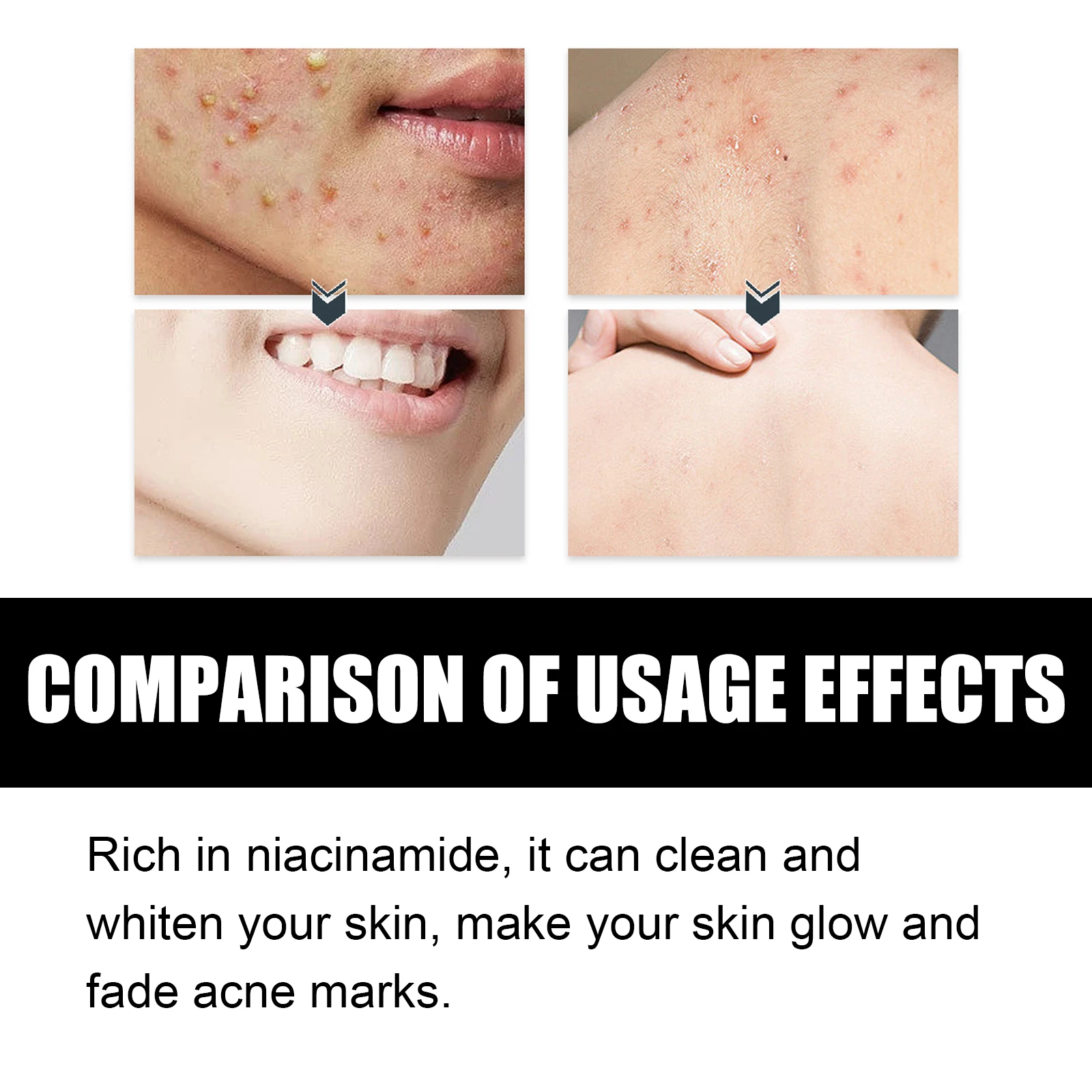 Man Niacinamide Soap Body Cleaning Whitening Glowing Smoothing Acne Marks Fading Acne Soap Bar for Men Face & Body Handmade Soap