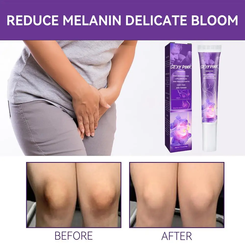 Body Whitening Cream Private Parts Underarm Bleaching Serum Whiten Butt Knee Brighten Inner Thigh Intimate Parts Dark Remove