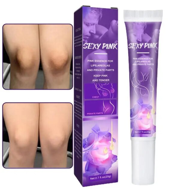 Body Whitening Cream Private Parts Underarm Bleaching Serum Whiten Butt Knee Brighten Inner Thigh Intimate Parts Dark Remove - Image 2