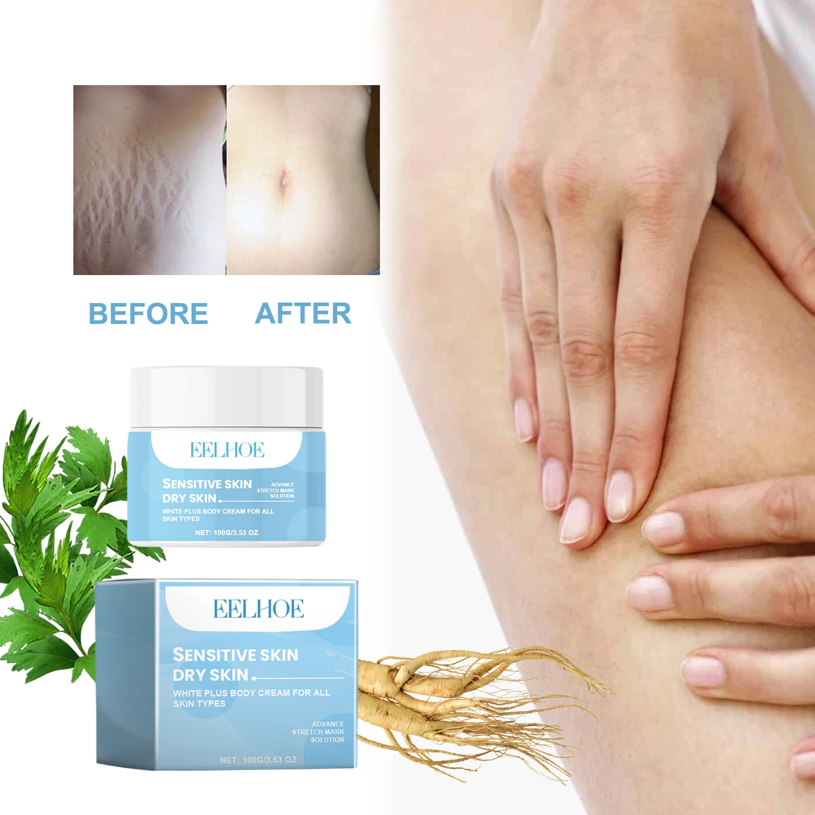 White Plus Body Stretch Marks Care Cream Lightens Dark Spots Reduces Wrinkles Tightens Skin Moisturizes And Hydrates Smooth Skin