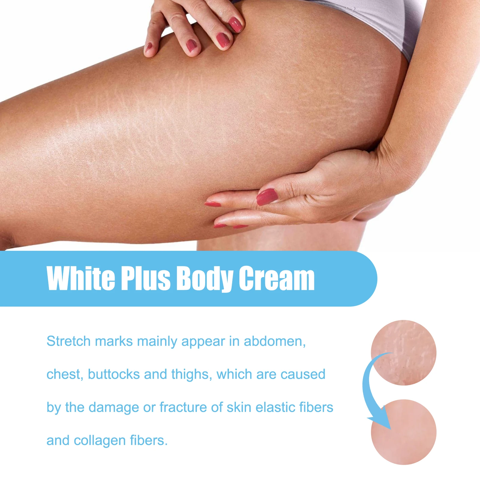 White Plus Body Stretch Marks Care Cream Lightens Dark Spots Reduces Wrinkles Tightens Skin Moisturizes And Hydrates Smooth Skin