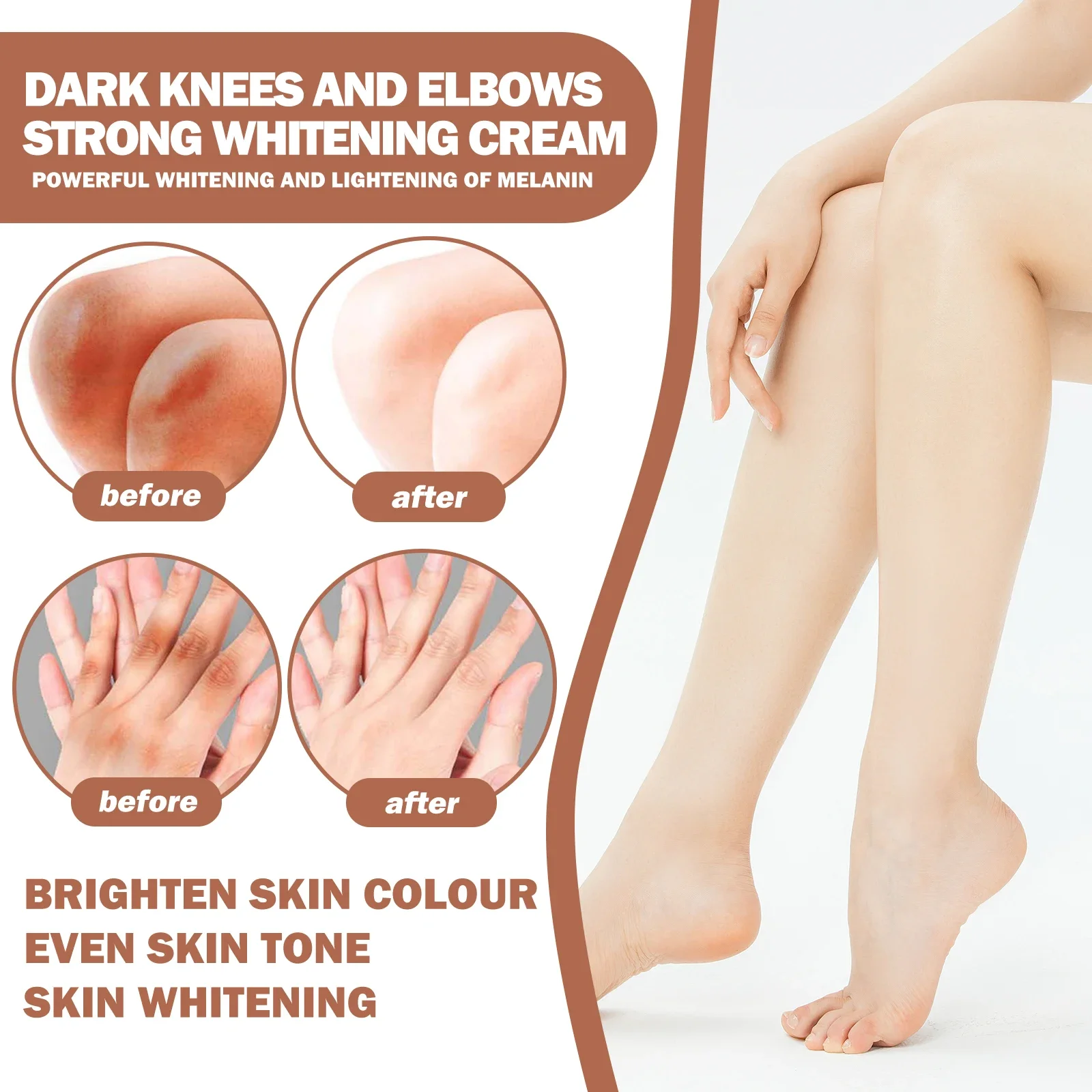 5Pcs Kojic Acid Whitening Cream Diminish Melanin In Joints Knees Hands Improve Dullness Moisturize & Brighten Body Care Products