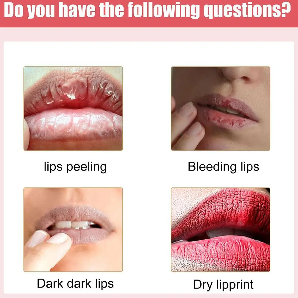 Lip Lightening Cream Dark Lips Removal Natural Moisturizing Lip Balm Nourish Fade Lines Lip Balm Brightening Dark Lips Cream 30g Lip Lightening Cream Dark Lips Removal Natural Moisturizing Lip Balm Nourish Fade Lines Lip Balm Brightening Dark Lips Cream 30g