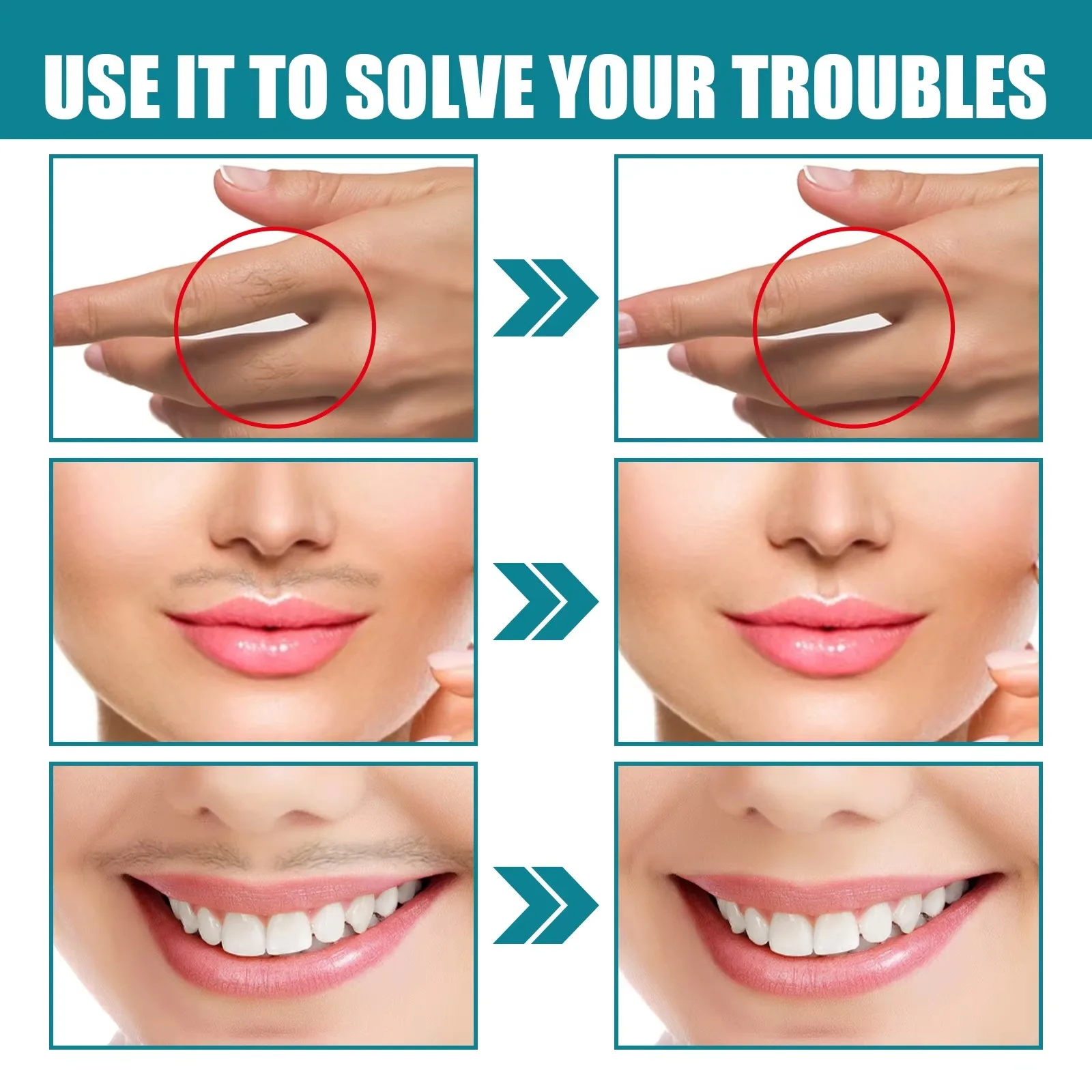 Lip hair removal cream quickly and gently removes lip hair, moisturizes and refreshes, suitable for both men and women