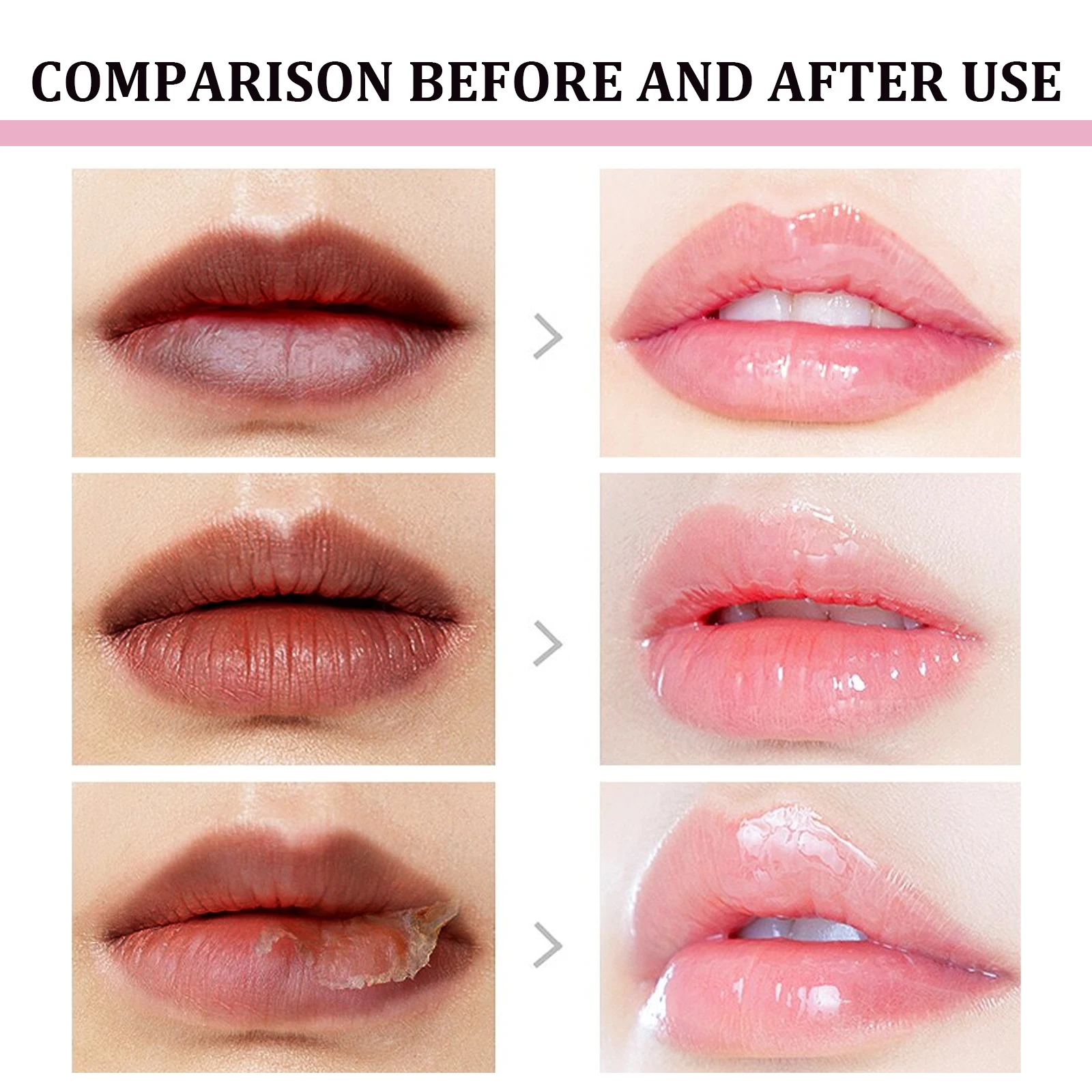 Remove Dark Lip Balm Lighten Melanin Lip Mask Exfoliating Fade Lip Line Dead Skin Moisturizing Brighten Repair Lip Care Products