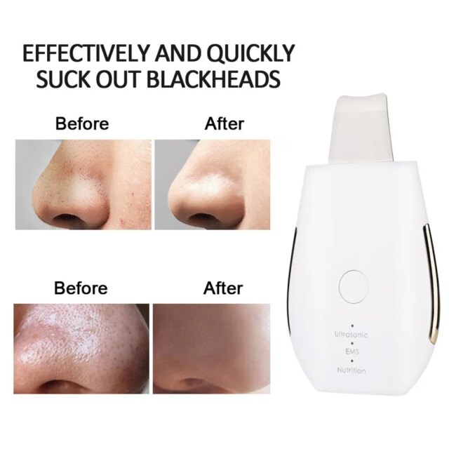 Rechargeable Ultrasonic Face Skin Scrubber Facial Cleaner Peeling Vibration Blackhead Removal Exfoliating Pore Cleaner Tools - Image 6