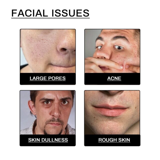 Men Vitamin E Facial Cleanser Deep Cleansing Keep Moisturize Reduce Blackhead Prevent Clog Pores Oil Control Face Care Cleansers - Image 5